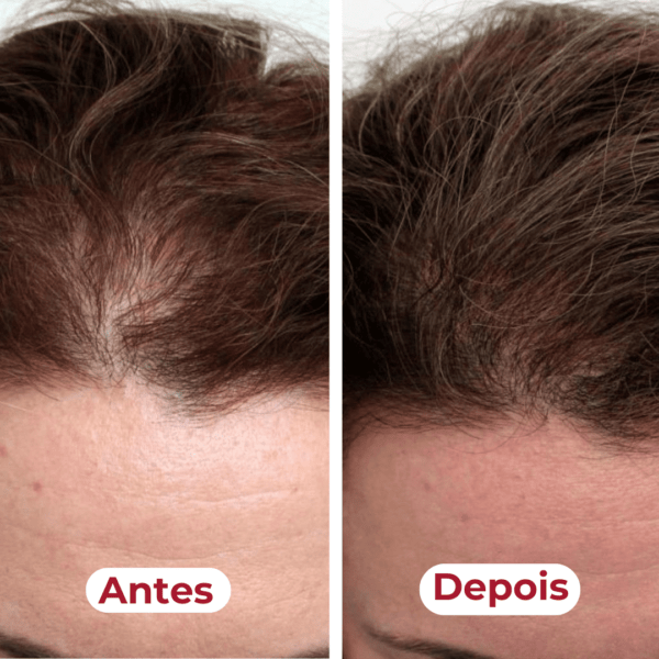 Antes e depois: raízes mais saudáveis e crescimento capilar